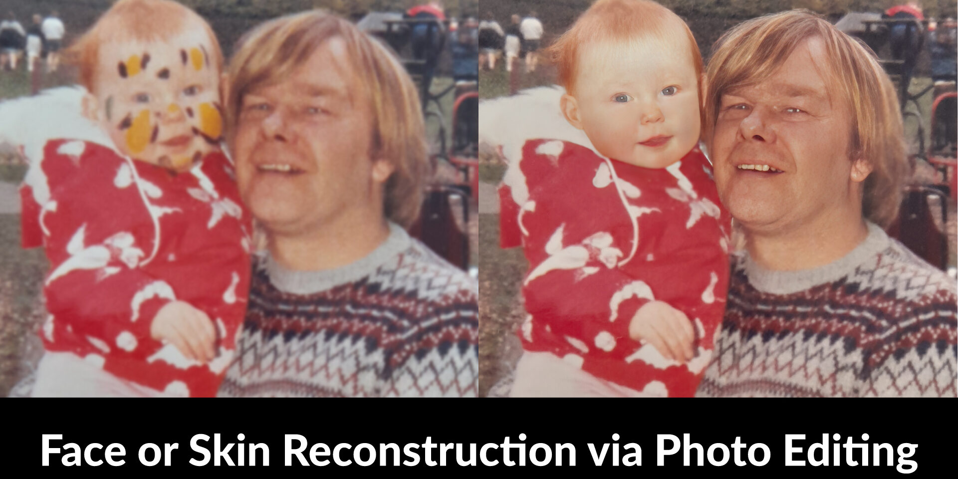 Face or Skin Reconstruction via Photo Editing Face or Skin Reconstruction via Photo Editing