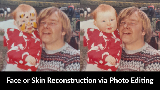 Face or Skin Reconstruction via Photo Editing